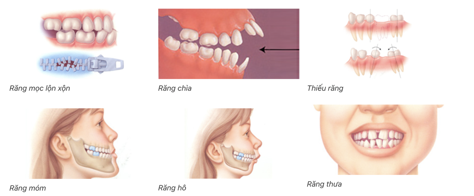 Chỉnh Nha Tại Kim Dung Biên Hoà